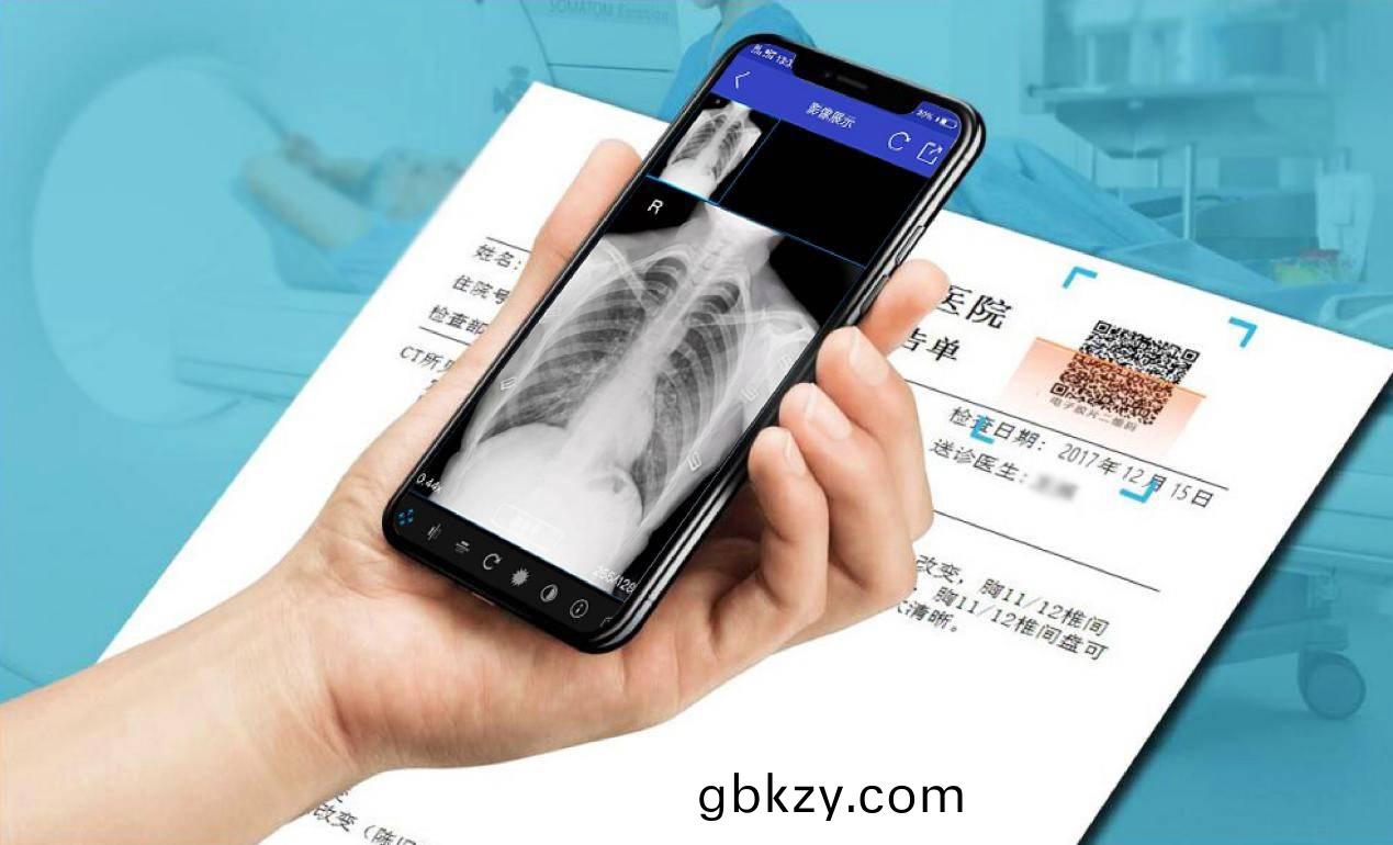 雲膠片(pian)昰(shi)什麼(me)？