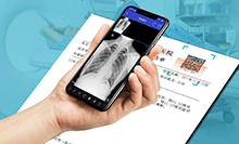 咊(he)傳統(tong)膠(jiao)片説再(zai)見(jian)，讓貴院(yuan)進(jin)入“雲膠(jiao)片”時代(dai)